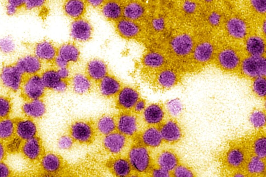 Virus periculos în Austria